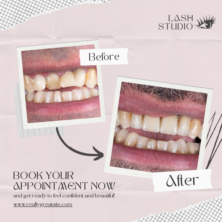 The before and after of a smile makeover