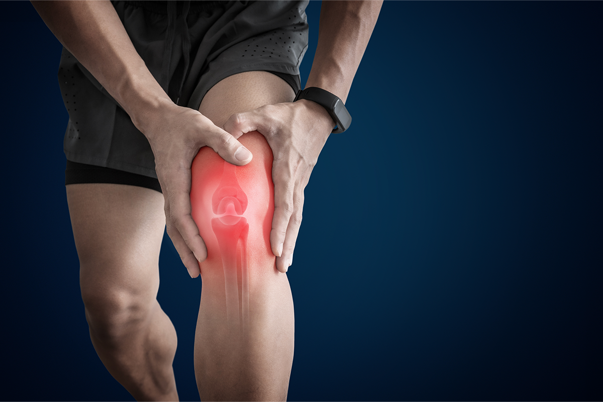 Arthritis: What It Is and How to Manage It